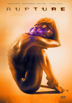 Rupture